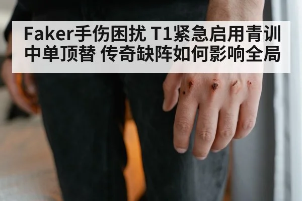 Faker手伤困扰 T1紧急启用青训中单顶替 传奇缺阵如何影响全局